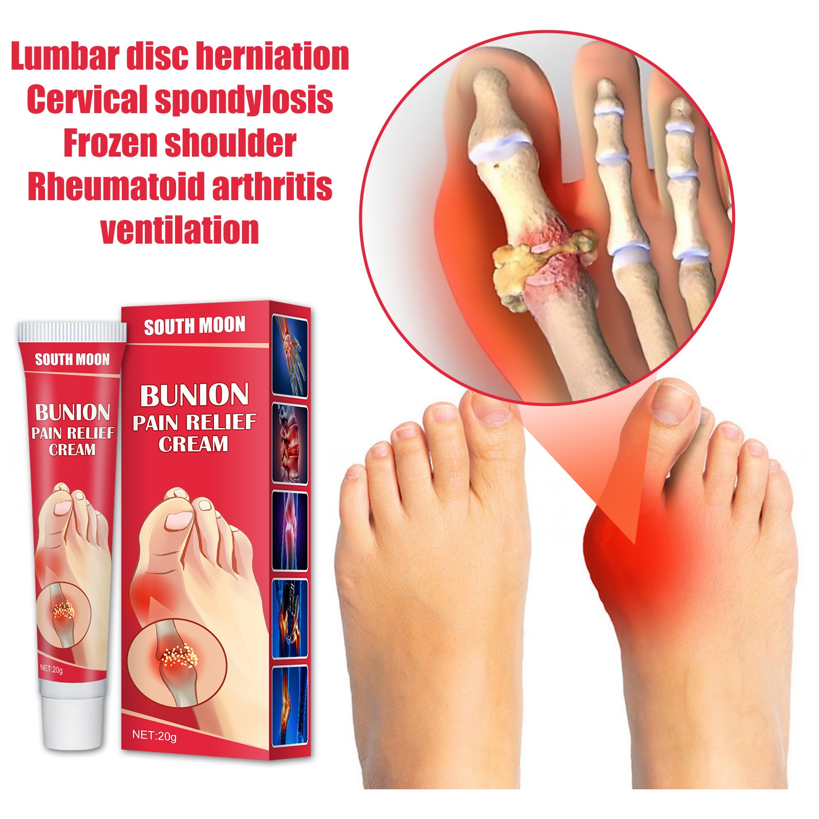 20g Bunion Gout Pain Relief Ointment Toe Joint Valgus Corrector Cream Hallux Knee Lumbar Arthritis Treatment Medical Plaster