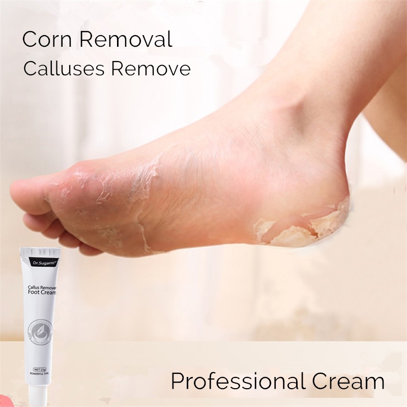 Medical foot care remove corns pads warts thorn treatment cream calluses remove callusitis detox professional foot cream