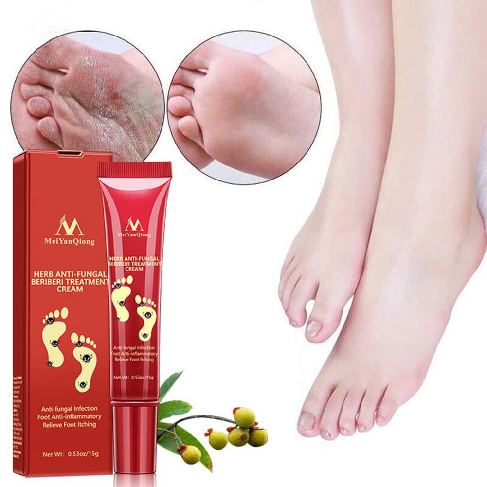Effective Herbal Foot Cream Treatment Anti Fungal Infection Paronychia Gel Treatment Toe Fungus Repair Dry Gel Detox Spa