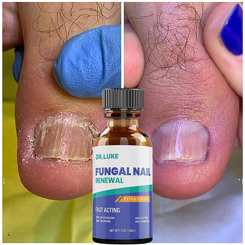 50ml Nail Repair Extract Anti Fungal Nail Treatment Remove Mycosis Nourishing Brighten Hand Foot Toes Nail Care