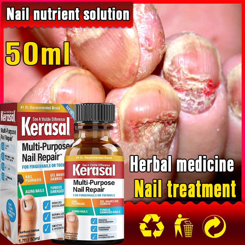 Nail Repair Serum Nail Fungal Treatment Serum Onychomycosis Paronychia Anti-Fungal Nail Infection Toe Fungus Foot Repair Care