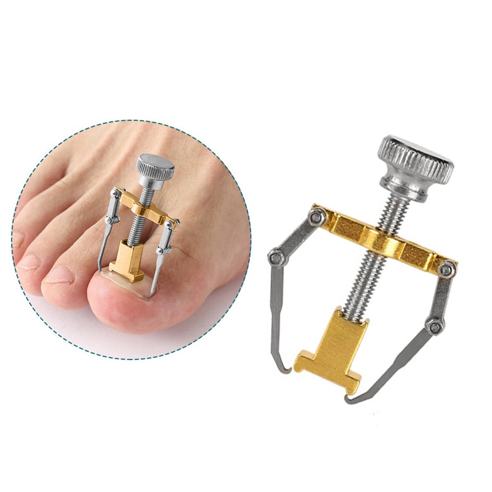 Ingrown Toenail Corrector, Treatment Clip, Paronychia, Toe Corrector, Toenail Fixer