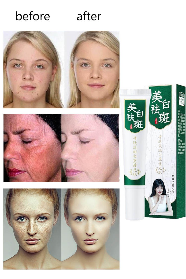 10pcs/20pcs Whitening Freckle Removal Cream Melasma Cream Remove Dark Spots Melanin Melanin Remover Skin Care Bleaching Cream