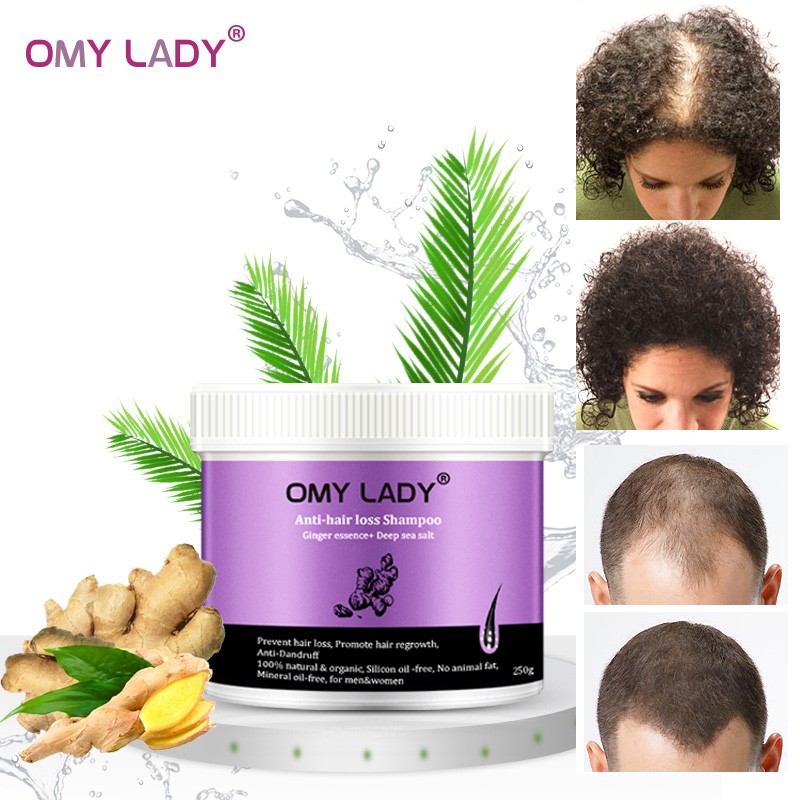 OMY Lady Ginger Anti Hair Loss Shampoo Promote Hair Growth Shampoo Hair Thick Fast Growth Serum Herbal Liquid For Men Women