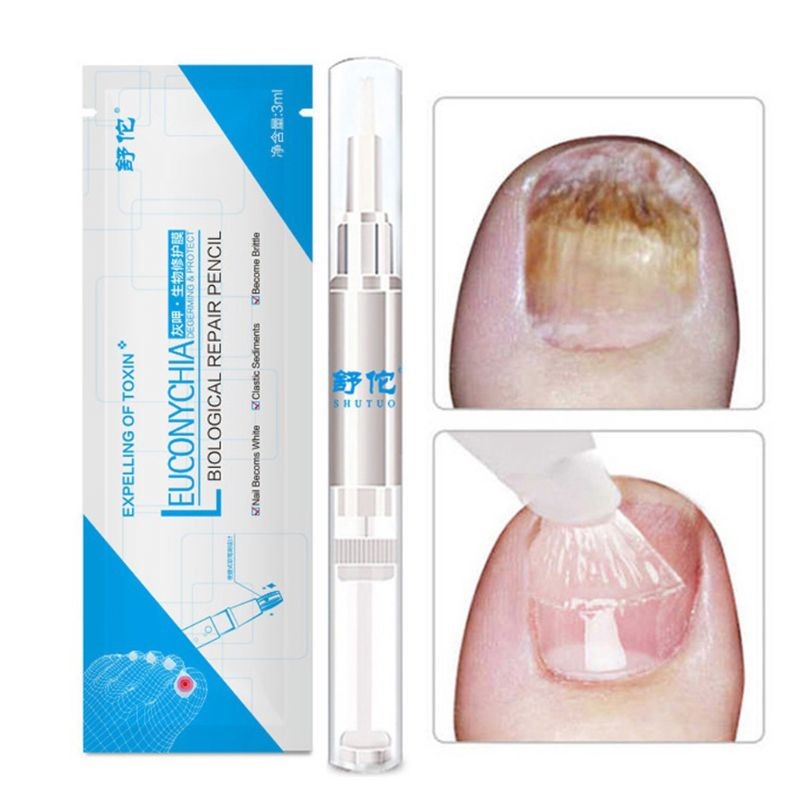 Fungal Nail Pen, 3ml, Effective, Onychomycosis, Paronychia, Anti-infection, Fungi, Repair Solution, Toenail Treatment Gel, Nourishing Essence