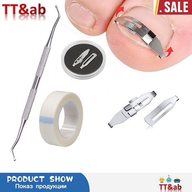 Carbon Steel Ingrown Toenails Pedicure Tool Straightening Correction Clip Curved Brace Thick Toenails Paronychia Correction