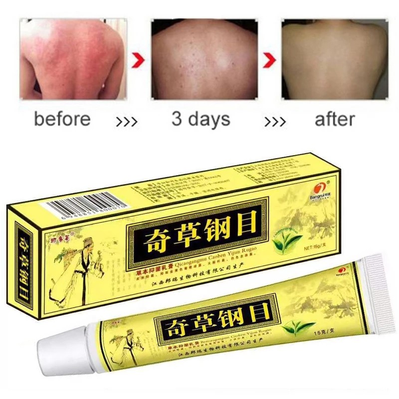 10pcs/lot Yiganerjing QICAOGANGMU Skin Psoriasis Cream + 5pcs Gift (without box)