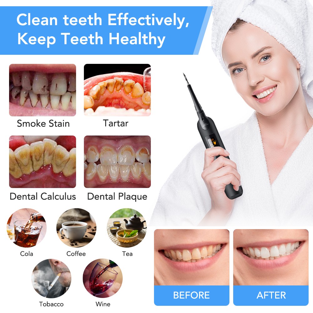 Teeth Whitener Sonic Sequins Plaque Calculus Tooth Remover Bleaching Kit Whitener Stone Cleaner LED Display Oral Hygiene Care Tools