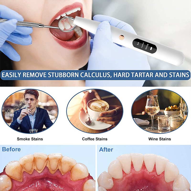 Dental Ultrasonic Calculus Scaler Dental Electric Tartar Calculus Plaque Stain Remover Dental Stone Removal With Led