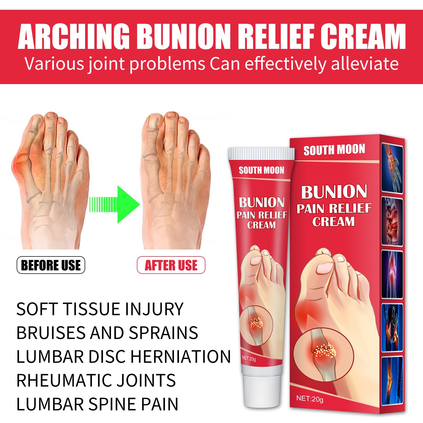 20g Bunion Gout Pain Relief Ointment Toe Joint Valgus Corrector Cream Hallux Knee Lumbar Arthritis Treatment Medical Plaster