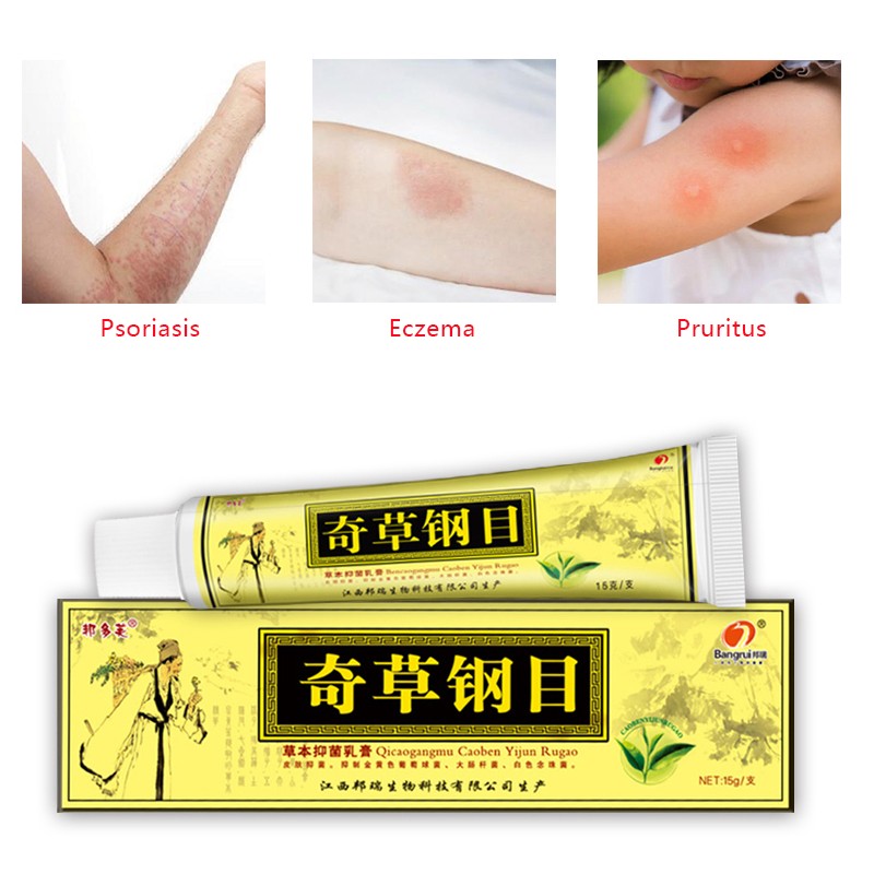 Bian Chicao Bing Skin Psoriasis Cream 999 Ointment of Psoriasis Psoriasis Treatment Relief Various Skin Problem