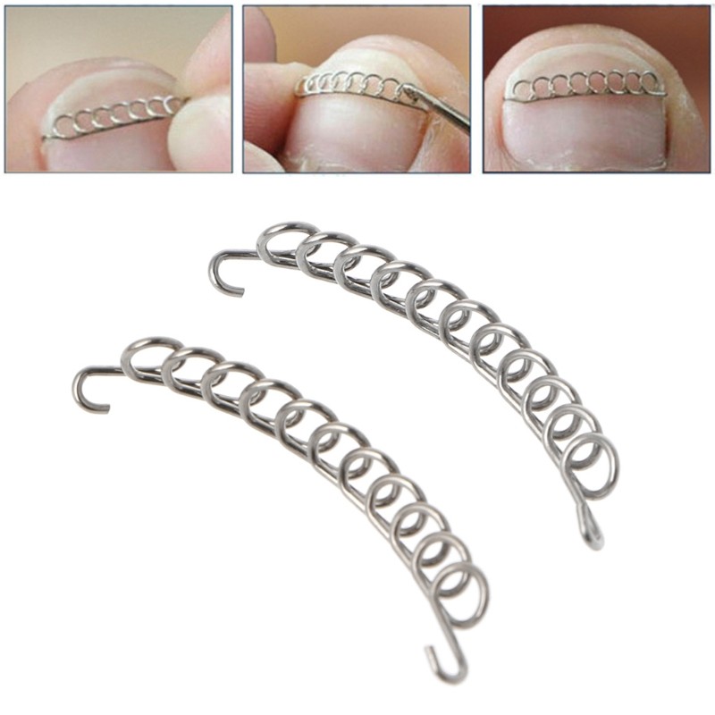 6pcs/box Stainless Steel Silver Ingrown Toe Nail Correction Pedicure Wire Fixer Paronychia Restoring Home Tool