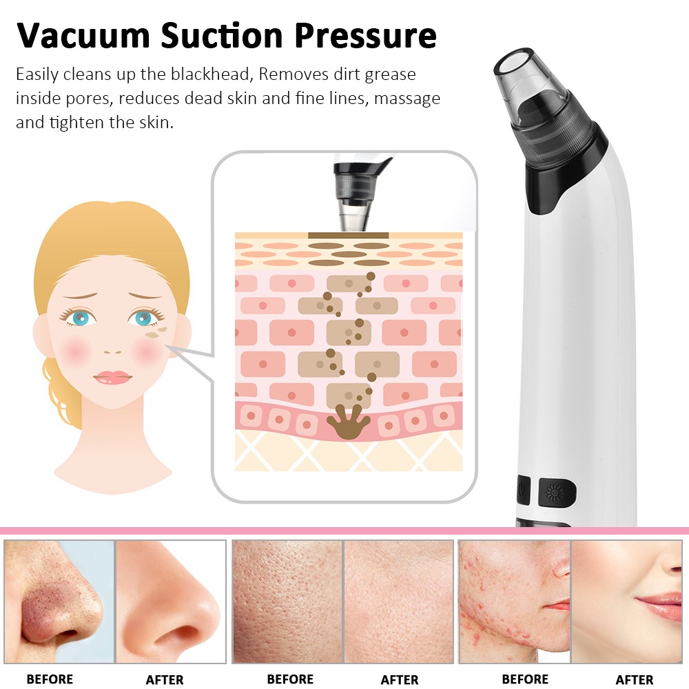 Facial Cleanser Blackhead Remover Deep Pore Acne Pimple Removal Vacuum Suction Diamond T Zone Beauty Facial Tool Household Spa