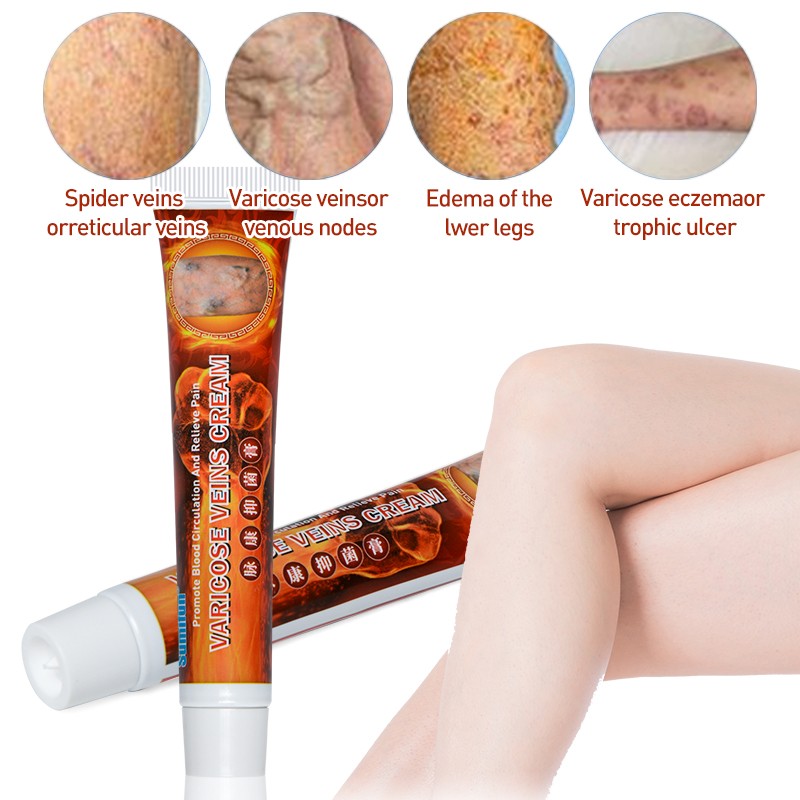 Sumifun New Varicose Veins Treatment Cream 100% Original Fibroid Vasculitis Spider Pain Relief Ointment Medical Plaster