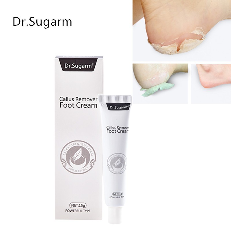 Medical foot care remove corns pads warts thorn treatment cream calluses remove callusitis detox professional foot cream