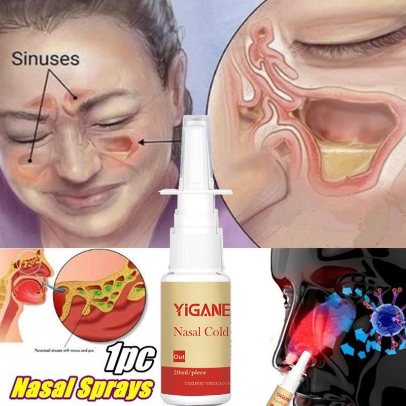 Natural Herbal Medical Nasal Spray Cure Rhinitis Sinus Nasal Spray Make Your Nose More Comfortable Good Effect