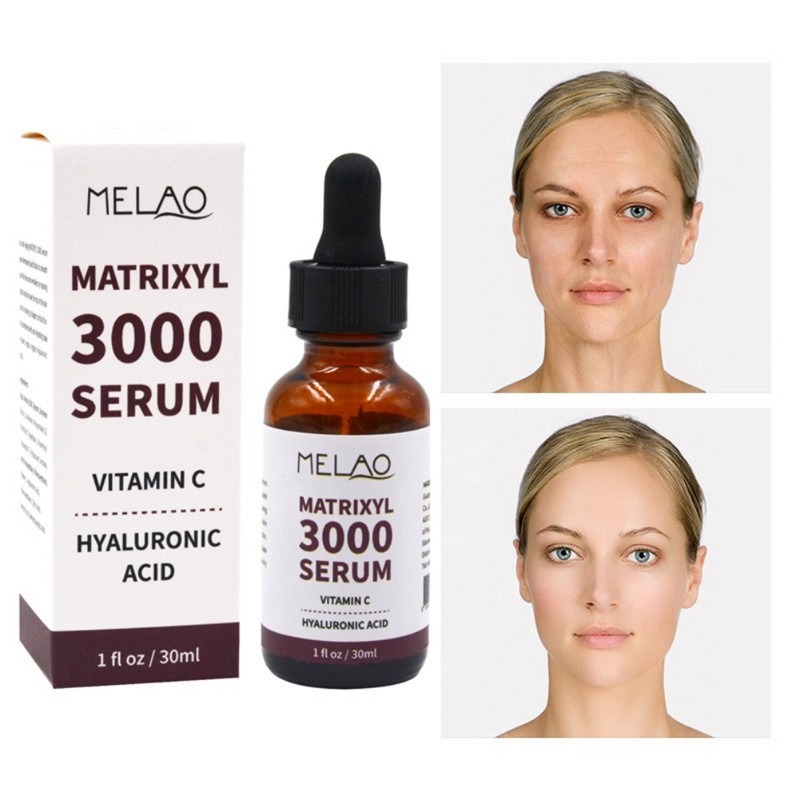 Matrixyl 3000 Vitamin C Serum Hyaluronic Acid Reduces Sun Spots Wrinkles Face Serum 30ml