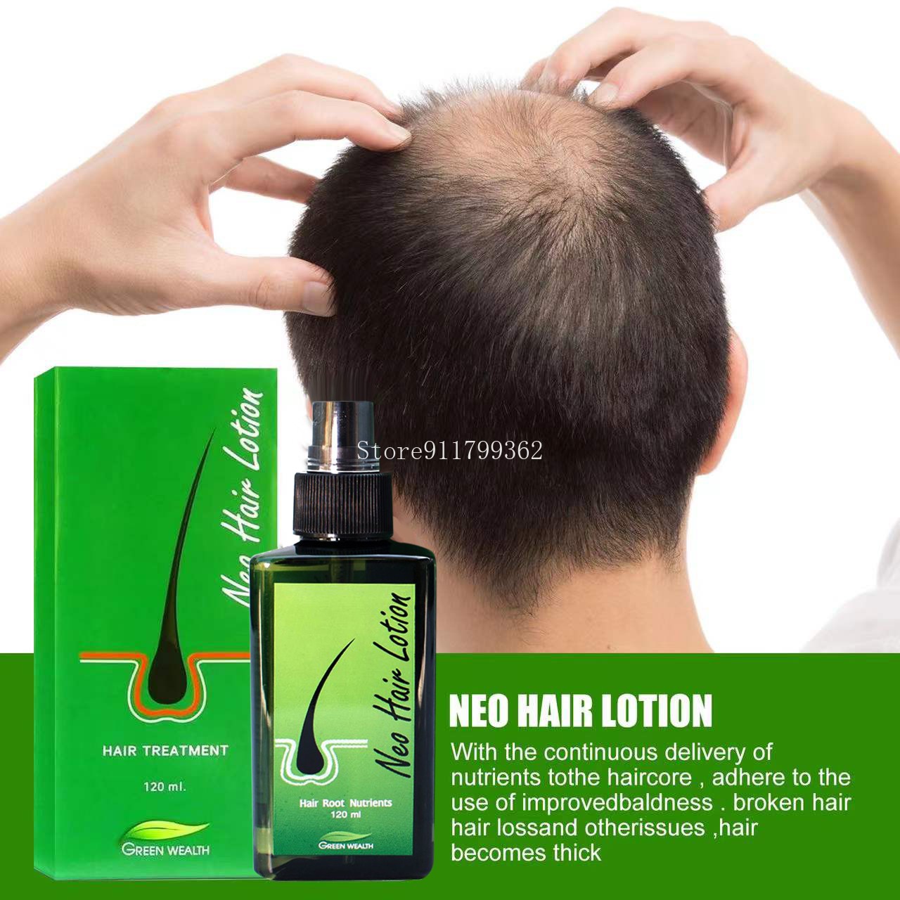 Hair Loss Treatment Growth Hair for Men Women1pcs120ml Neo Hair Lotion Hair Growth Serum Essence Oil