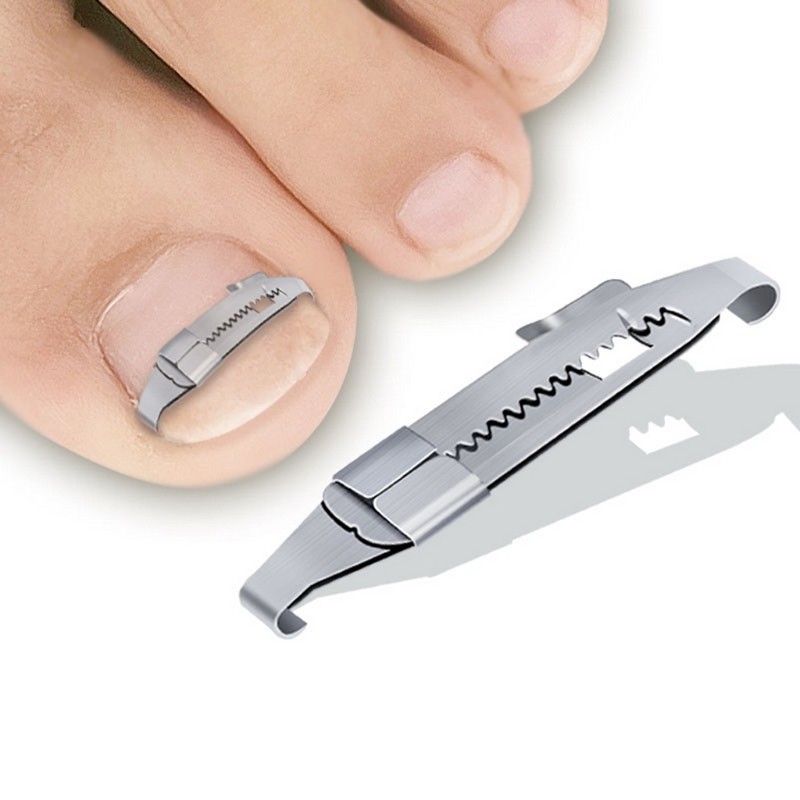 Carbon Steel Ingrown Toenails Pedicure Tool Straightening Correction Clip Curved Brace Thick Toenails Paronychia Correction