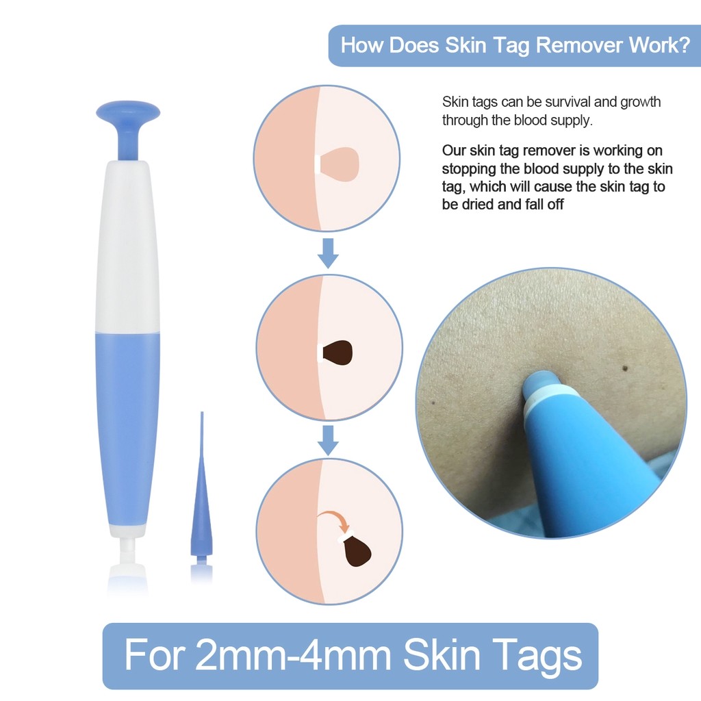 Warts & Warts Removal Kit Skin Tag Killing Skin Moles Fine Skin Tag With Cleansing Adult Warts Face Care