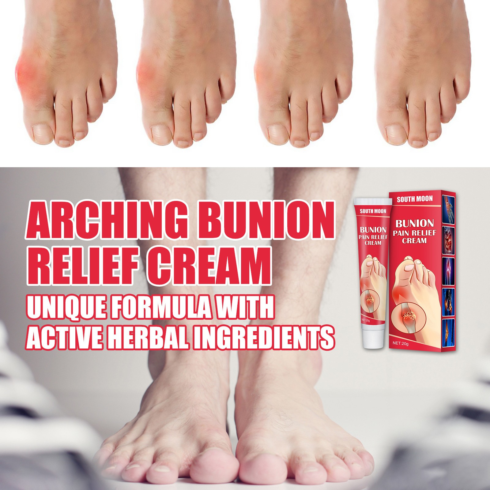 20g Bunion Gout Pain Relief Ointment Toe Joint Valgus Corrector Cream Hallux Knee Lumbar Arthritis Treatment Medical Plaster