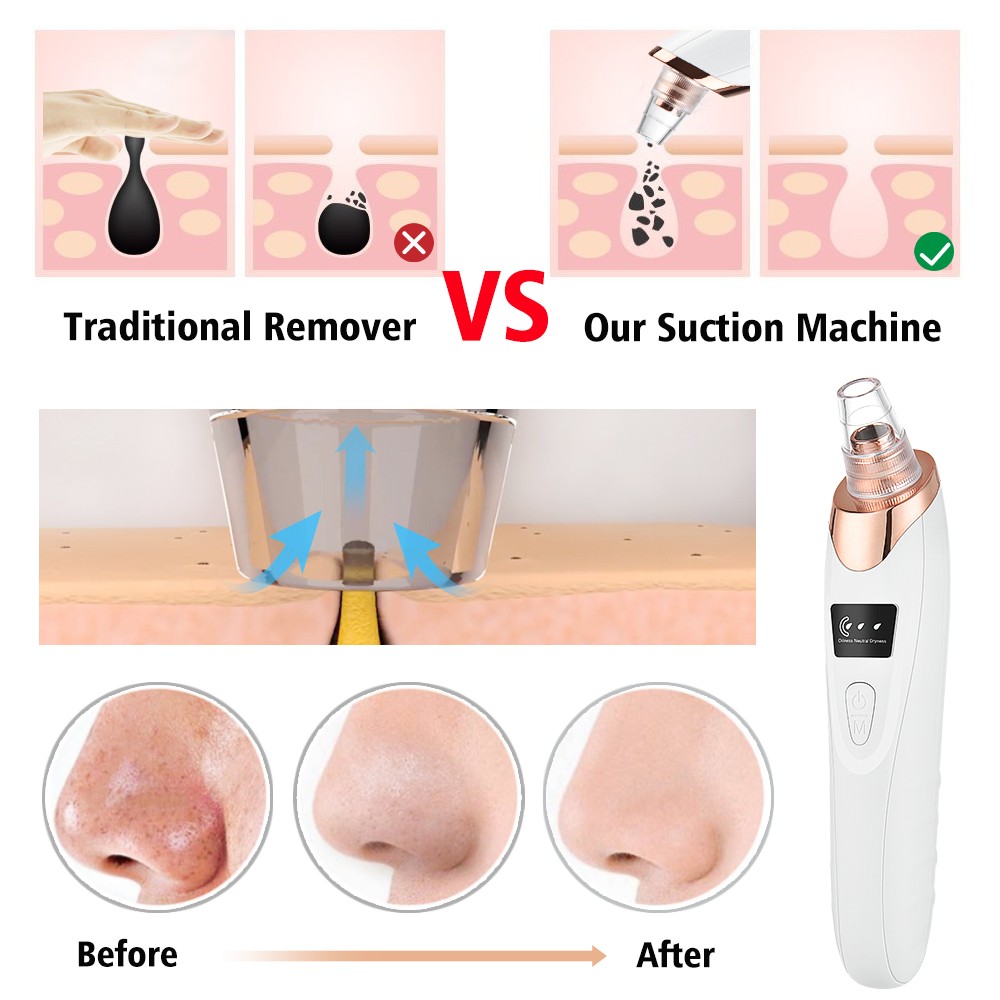 Blackhead Suction Blackhead Remover Black Skin Suction Blackhead Remover Facial Pore Cleaner Dropship Skin Peeling Beauty Device