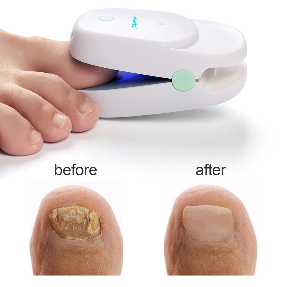 Nail Cleaning Infrared LED Light Therapy For Nail Fungus Cold Laser Physiotherapy