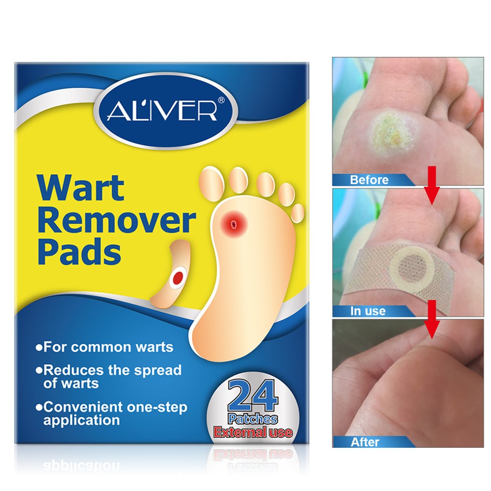 1box=24pcs Feet Warts Remover Pads Calluses Patch Plantar Chicken Eye Corn Stickers Pain Relief Pad Foot Care Plaster