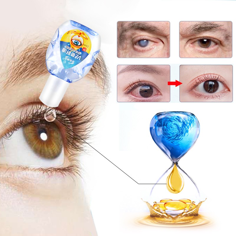 15ml Eye Drops For Cataract Treatment Eyes Cod Liver Oil Cool Cleaning Drop Remove Eyeball Fatigue Injured Eyes Toxin