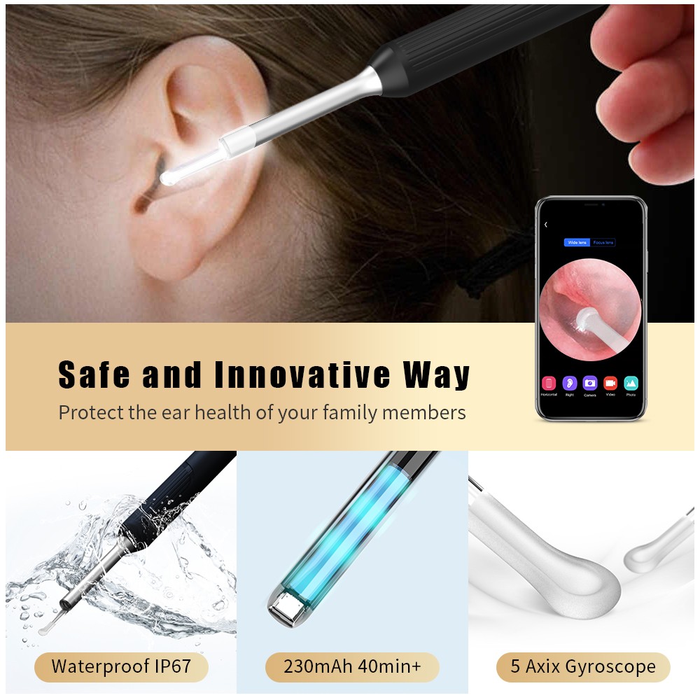 NP20 Smart Ear Cleaner Stick with Endoscope 400W High Precision Wireless Earwax Remover Set Rechargeable Otoscope Cleaning Tools