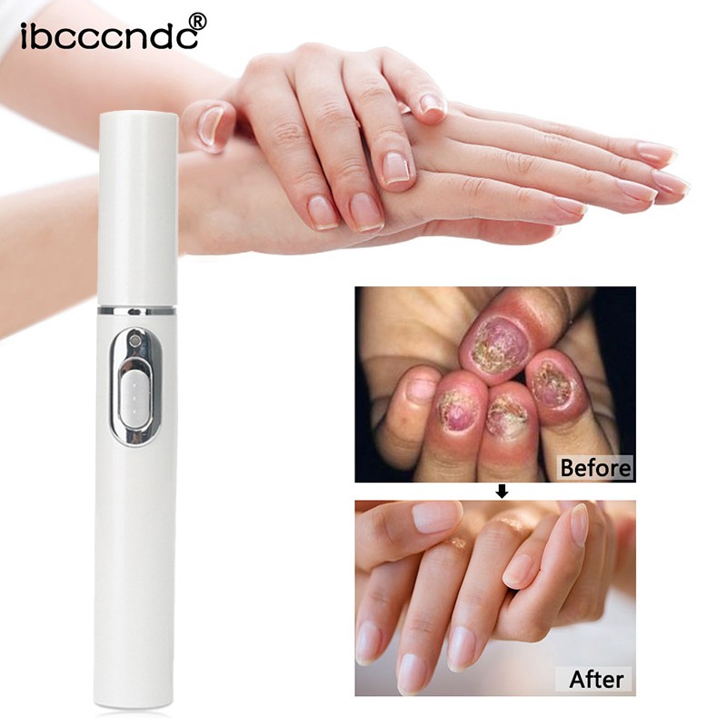 Nail Fungus Pen Anti Fungus Home Set Toe Nail Onychomycosis Paronychia Anti Fungus Care Repair Serum