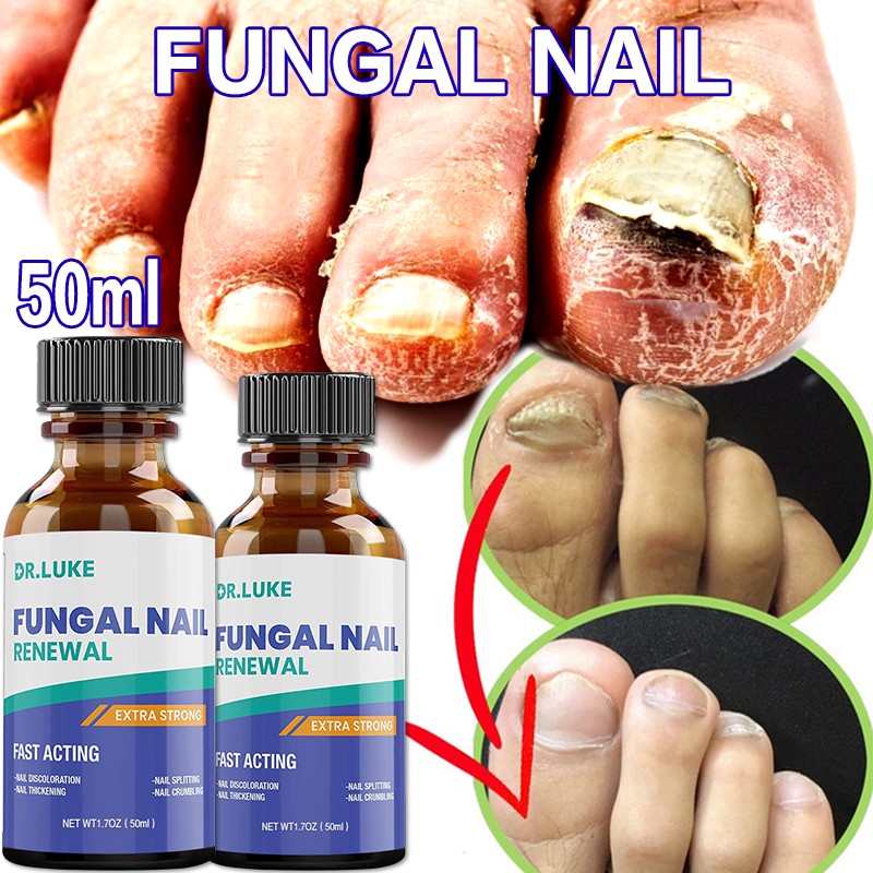 50ml Nail Repair Extract Anti Fungal Nail Treatment Remove Mycosis Nourishing Brighten Hand Foot Toes Nail Care