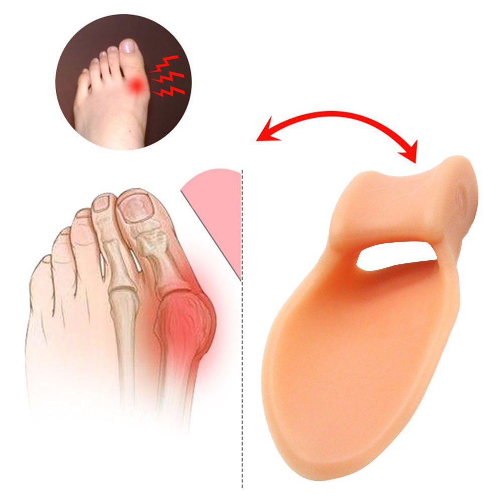 2pcs Silicone Gel Big Toe Separator Bunion Orthopedic Ectropion Toes Corrector Separator Valgus Finger Straightener