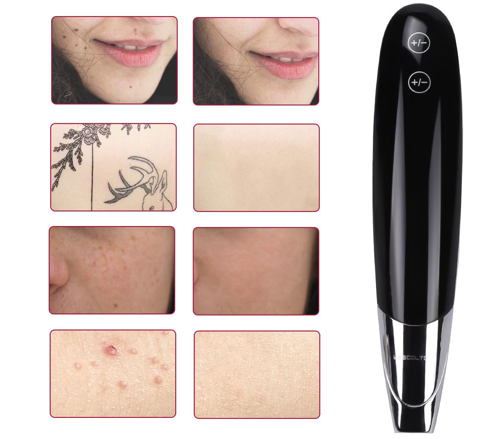 Professional Picosecond Laser Pen Blue Light Therapy Freckle Tattoo Mole Removal Dark Spot Eyebrow Pigment Acne Laser Pen