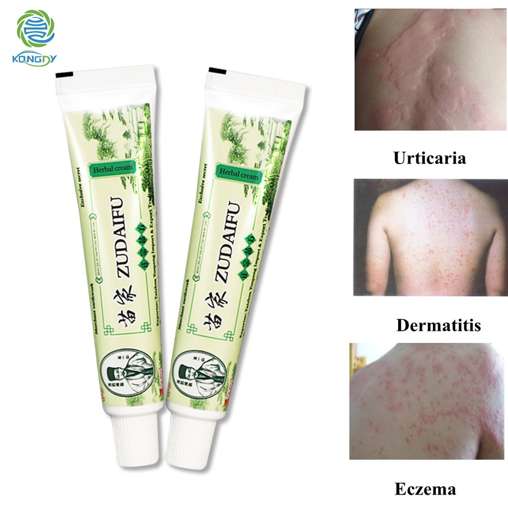 Hot Sale 1pc Yiganerjing Zudaifu Body Psoriasis Cream 15g (without box)