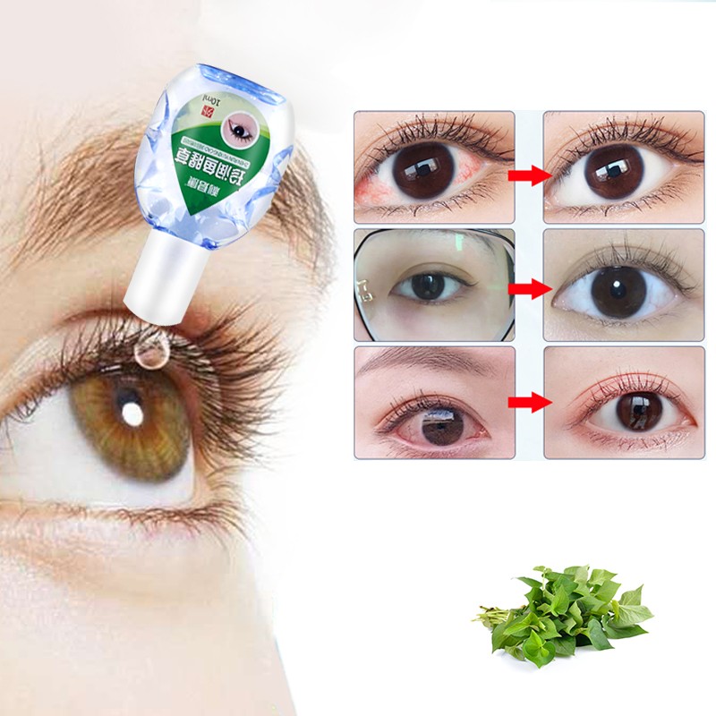 Infected red eye remove clean drop eyeball fatigue medical eyes cleanse toxins relieves discomfort eye care drops