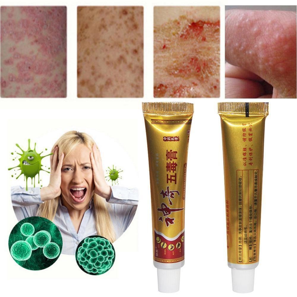 YIGANERJING Useful Psoriasis Cream Psoriasis Ointment Eczematoid Dermatitis Ointment Moisturizing Skin Cream