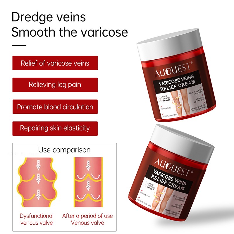 AUQUEST Varicose Veins Relief Cream Vasculitis Spider Pain Relief Ointment Medical Plaster Body Care 80g