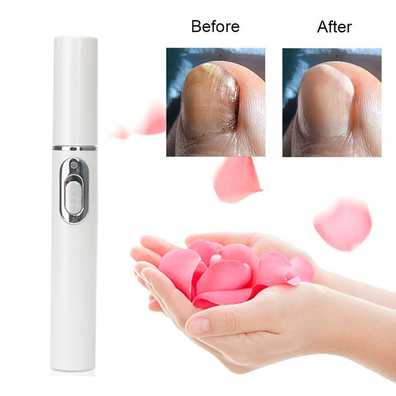 Nail Fungus Pen Anti Fungus Home Set Toe Nail Onychomycosis Paronychia Anti Fungus Care Repair Serum