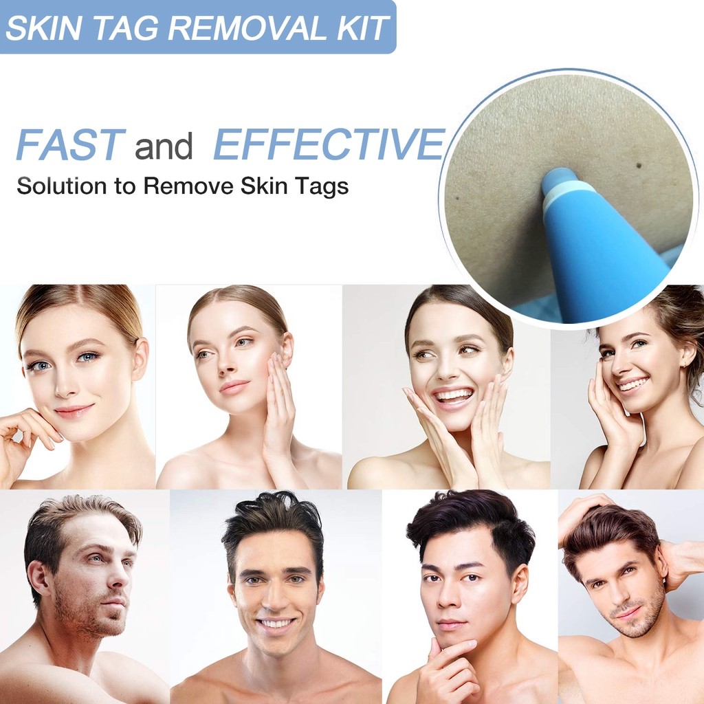 Warts & Warts Removal Kit Skin Tag Killing Skin Moles Fine Skin Tag With Cleansing Adult Warts Face Care