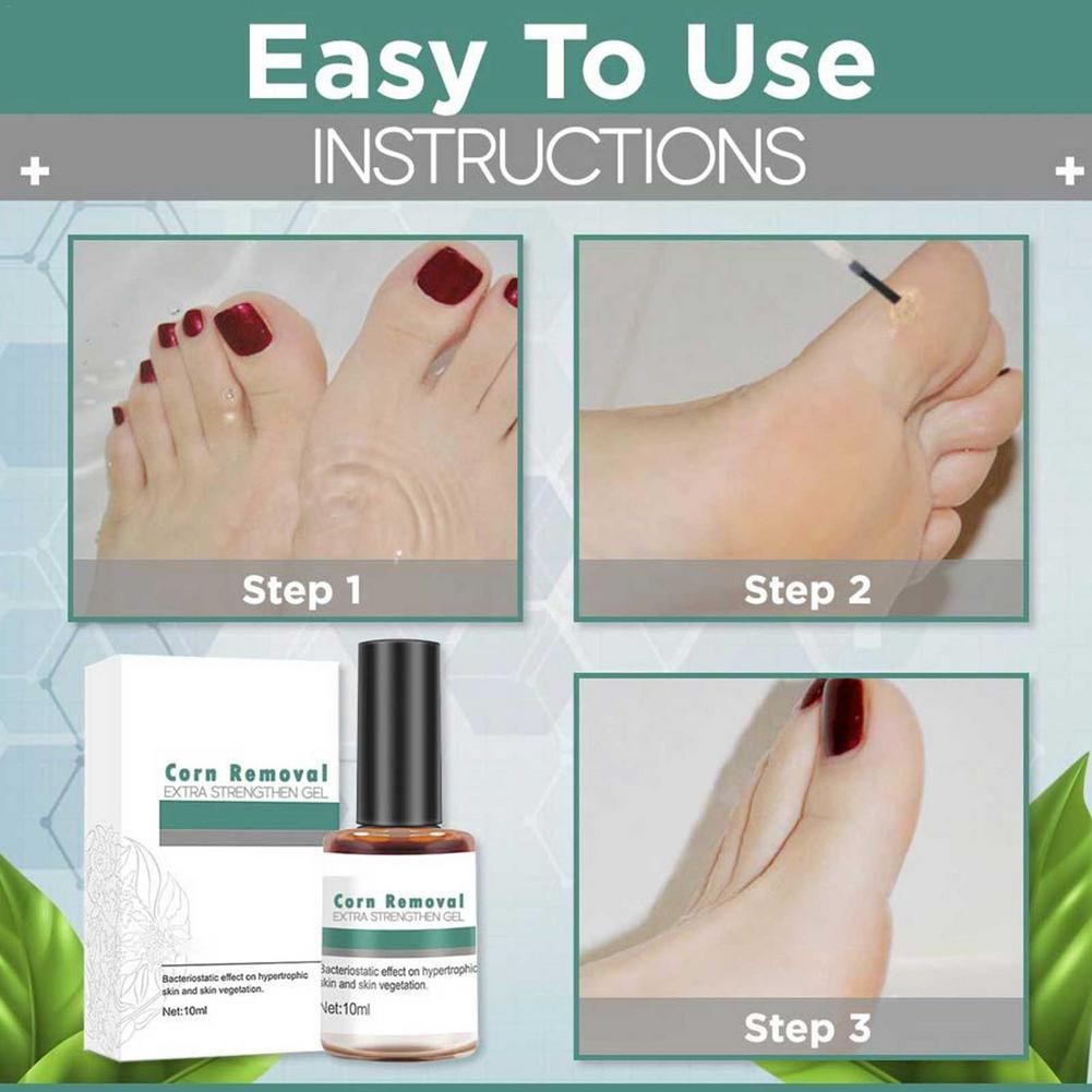 Wart Removal Extra Enhancement Gel Foot Care Health Care Liquid Smoothing Foot Essence Skin Painless Removal of Corns Treatment