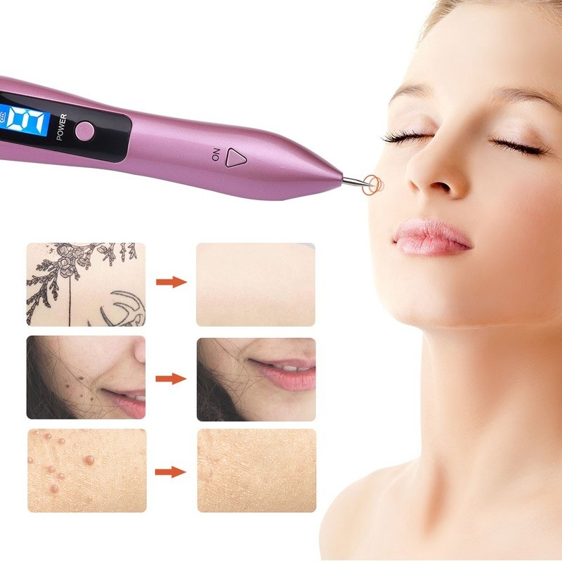 Dark spots removal pen, remove tattoos and spots from the skin and get rid of any marks