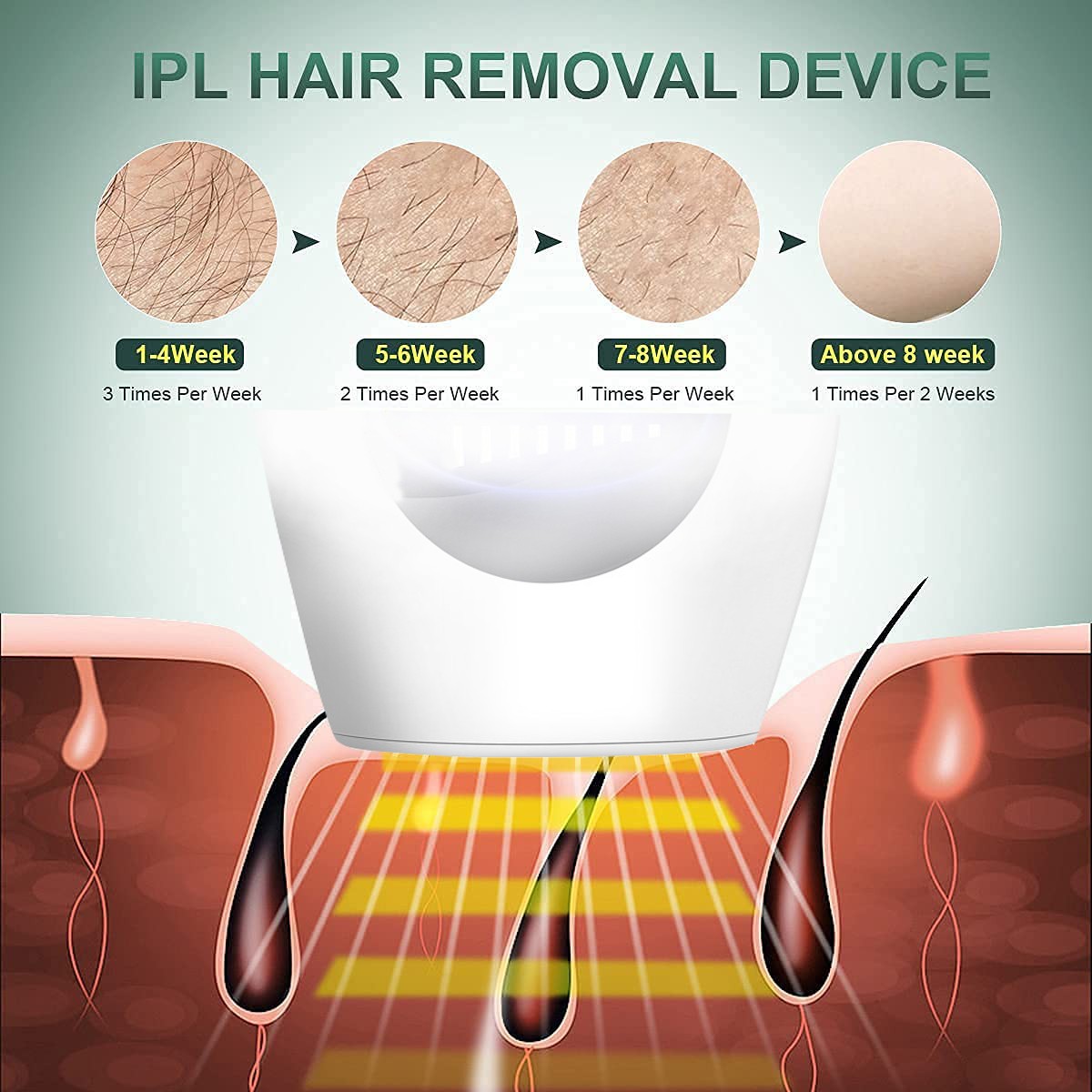 2022New 900000flash es آلة لنزع الشعر بالليزر الليزر الساخن بيع دائم IPL آلة إزالة الشعر بالليزر آلة إزالة الشعر الكهربائية غير مؤلم