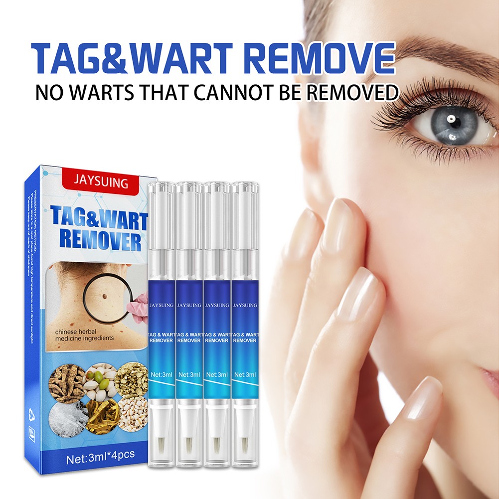 Anti Moles Removal Liquid Pen Treatment Papilloma Removal Wart Liquid From Skin Tags Remover Anti Recura Treatment