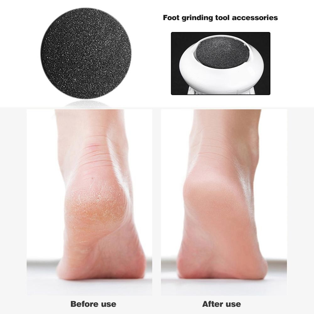 Electric Foot Grinder Vacuum Adsorbed Dead Skin Callus Remover Hard Cracked Files Skin Files Multifunctional Clean Tools Feet Care