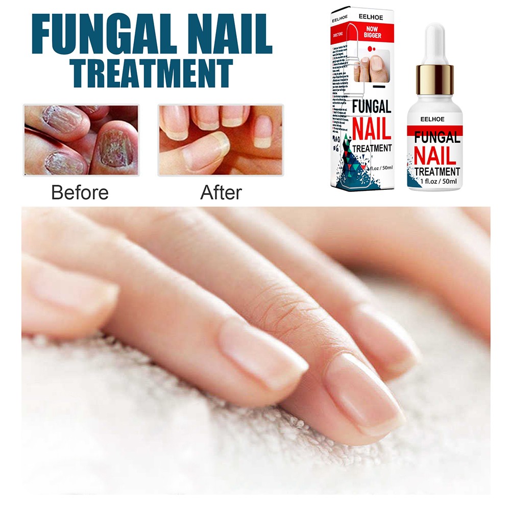 50ml Nail Repair Extract Anti Fungal Nail Treatment Remove Mycosis Nourishing Brighten Hand Foot Toes Nail Care