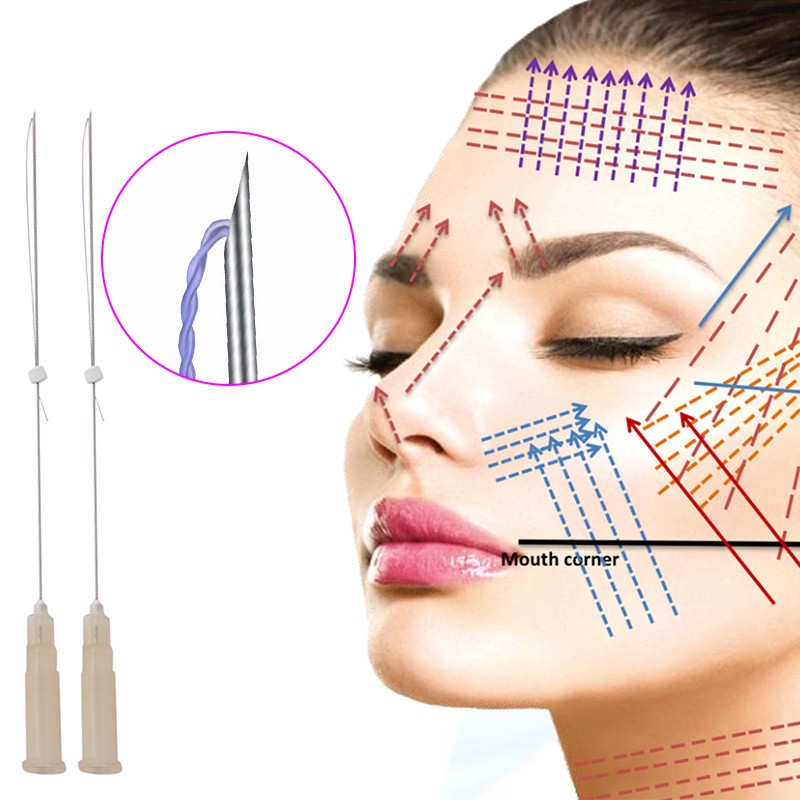 20pcs Korea PCL Hilos Tensores Faciales Single Suture Lifting Tornado/Screw Facial Pdo Thread Lifting Face Lift