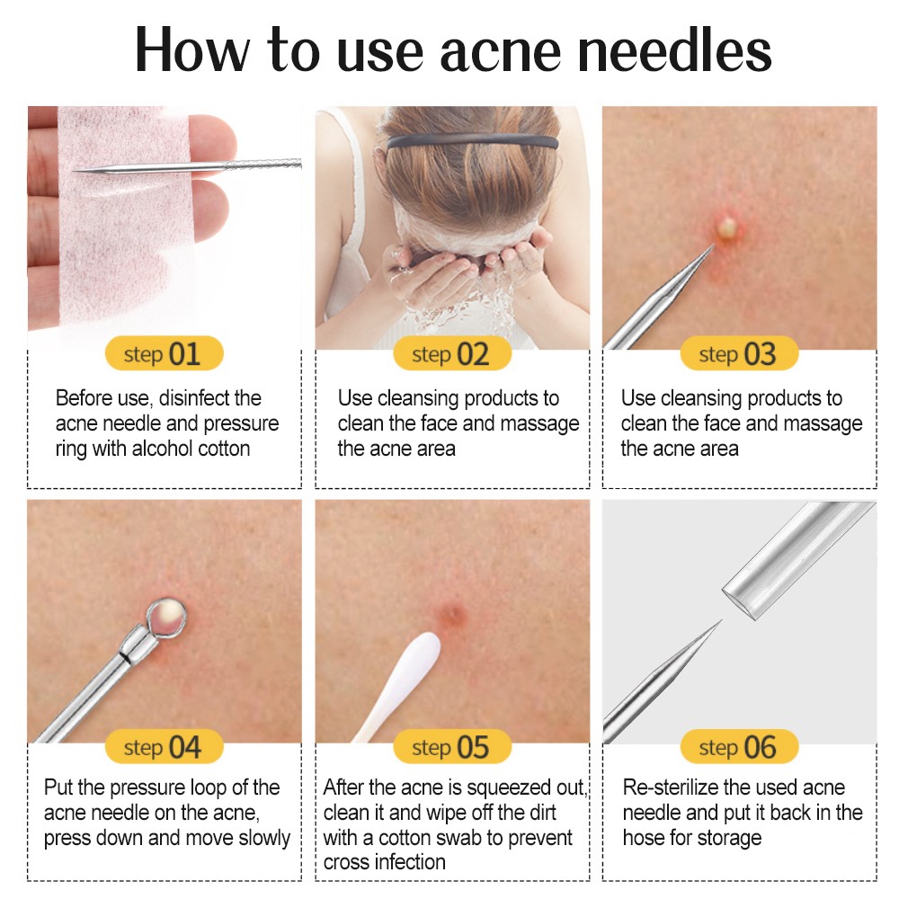 8/7/5pcs Acne Blackhead Removal Needles Black Dots Cleaner Black Head Pore Cleaner Deep Cleansing Tool Face Skin Care Tool