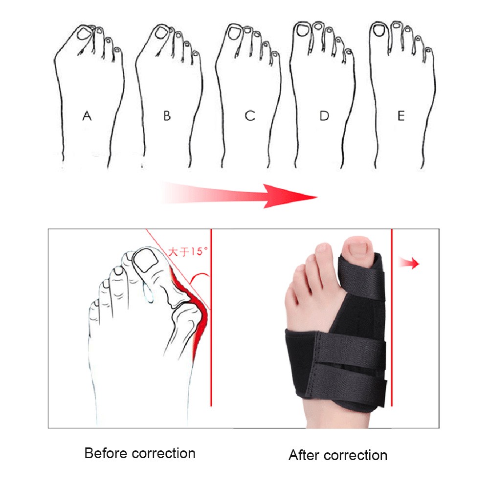 2pcs Soft Bunion Corrector Toe Spacer Splint Correction System Hallux Valgus Foot Care Pedicure Orthotics