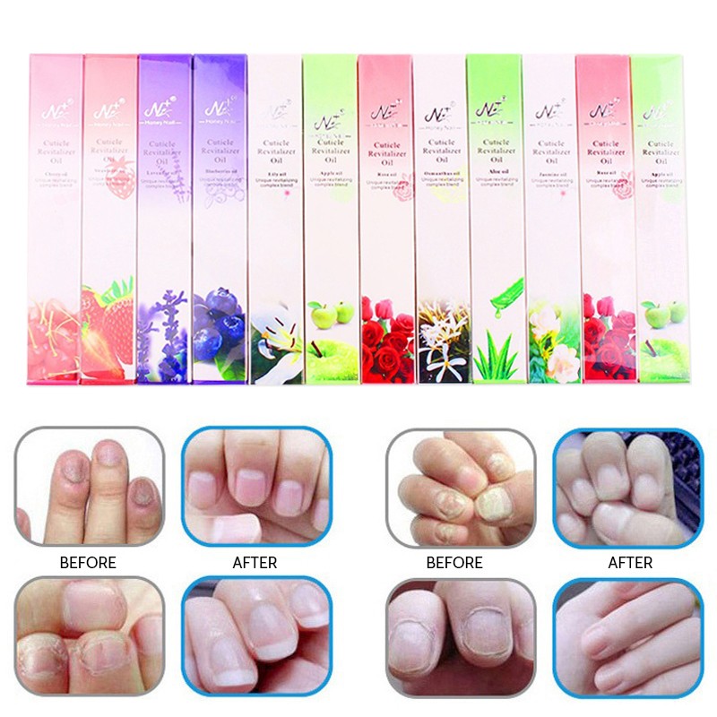 3ml Nail Repair Liquid Pen With Brush Cute Anti Fungus Remover Onychomycosis Paronychia Foot Nail Fungus For Nails Manicure